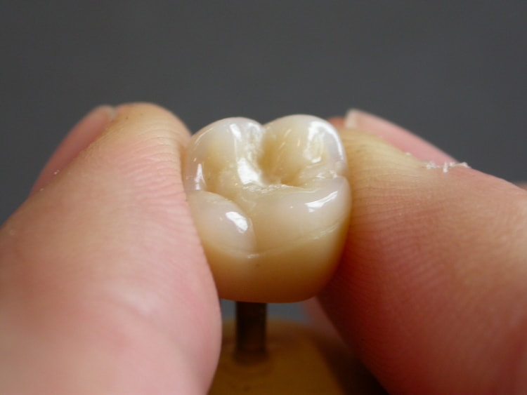04_dental_crown_toot_mejfc.jpg
