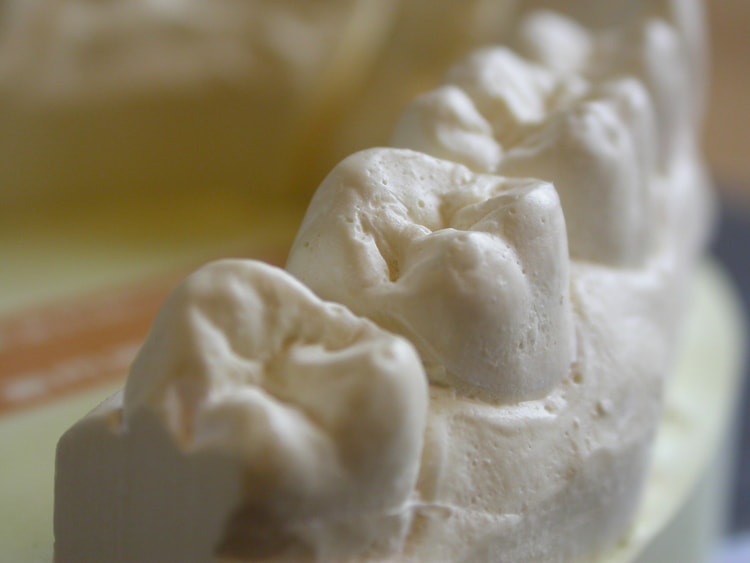 06_dental_moulds_dsc_sJpkp.jpg